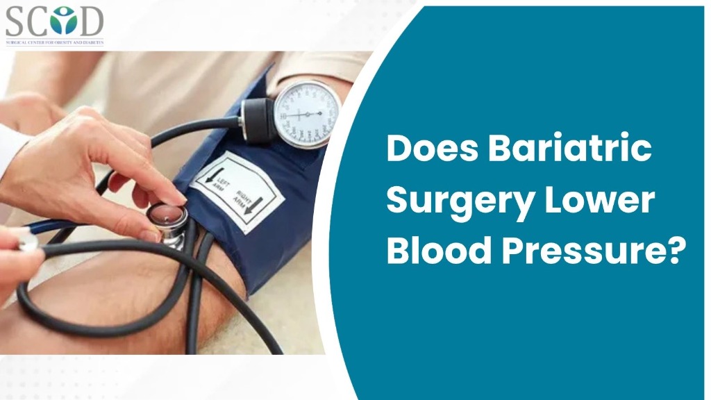 Does Bariatric Surgery Lower Blood Pressure?
