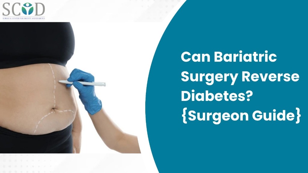 Can Bariatric Surgery Reverse Diabetes?