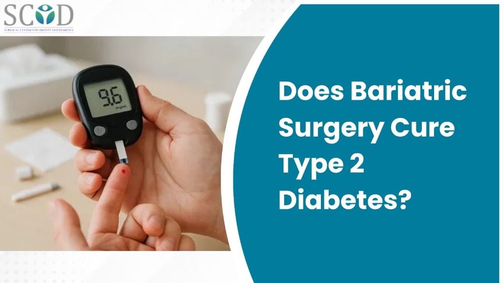 Does Bariatric Surgery Cure Type 2 Diabetes?