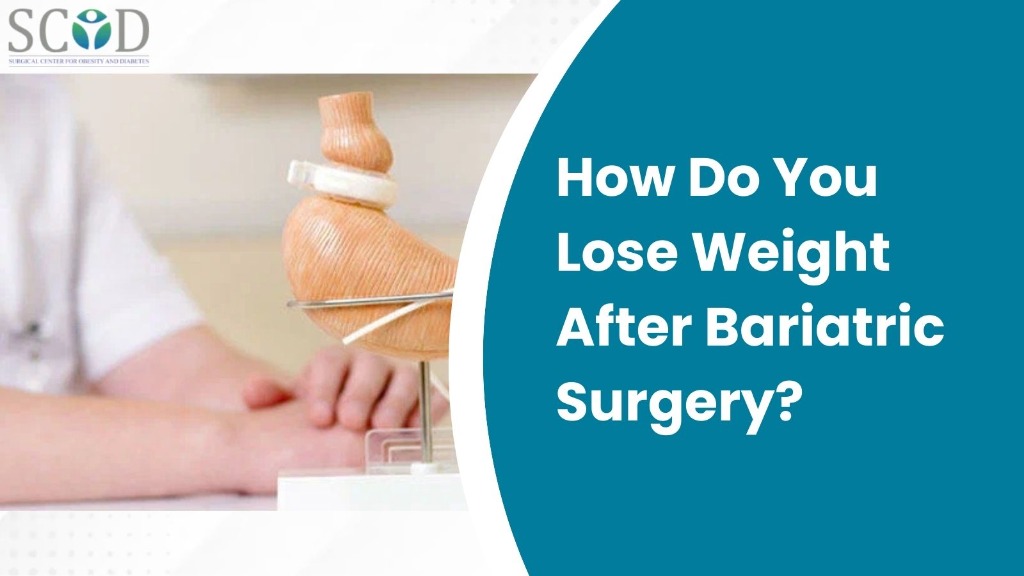 How Do You Lose Weight After Bariatric Surgery?