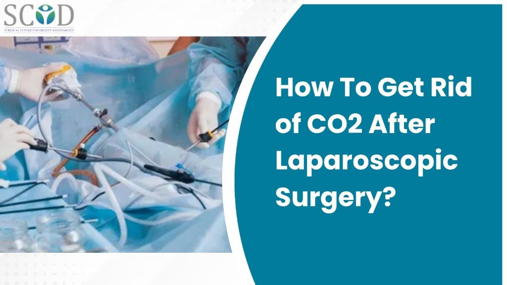 How To Get Rid of CO2 After Laparoscopic Surgery?